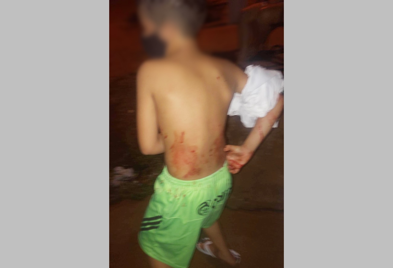 Cães de ruas atacam criança na noite desta segunda-feira (17) em Patos