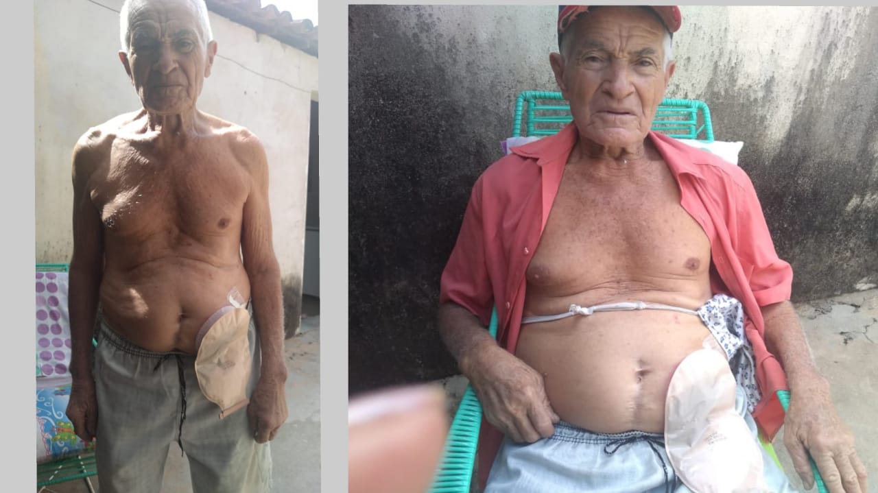 Campanha solidária em prol da Cirurgia de 'Seu Cosme' de Mãe d'Água