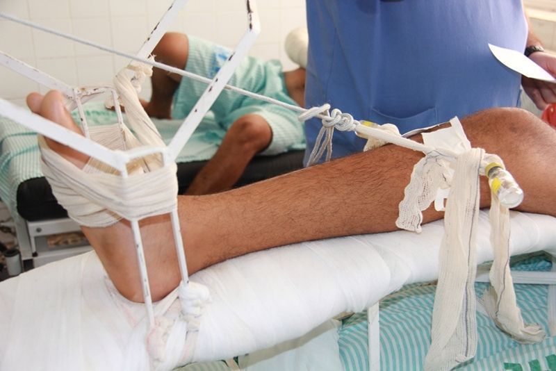 23 vítimas de acidentes envolvendo motocicletas são atendidas no fim de semana na Urgência e Emergência do Hospital de Patos