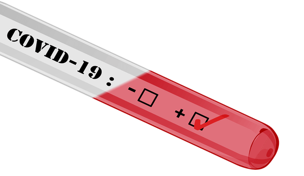 Paraíba teve 5 mortes e 579 novos casos em decorrência da covid-19. 21% é a taxa de ocupação dos leitos