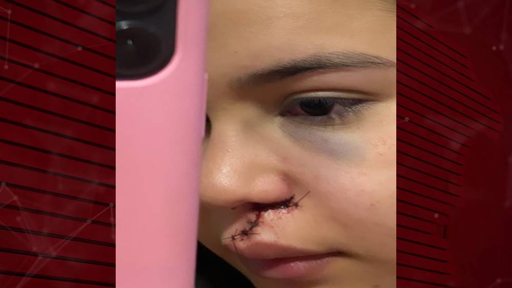 Jovem de Cajazeiras é agredida com garrafada após negar dança a homem em vaquejada