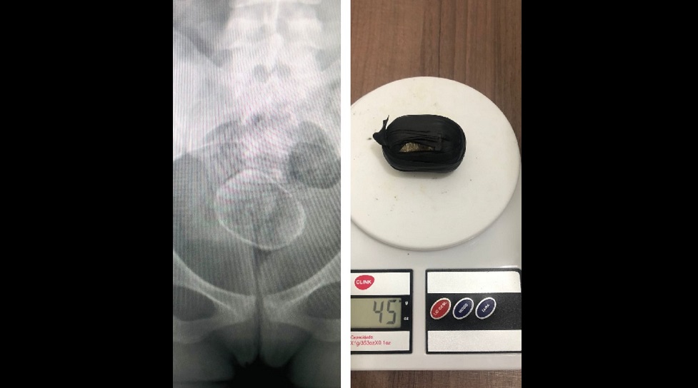 No Sertão: Mulher tenta entrar em presídio com droga introduzida no próprio corpo