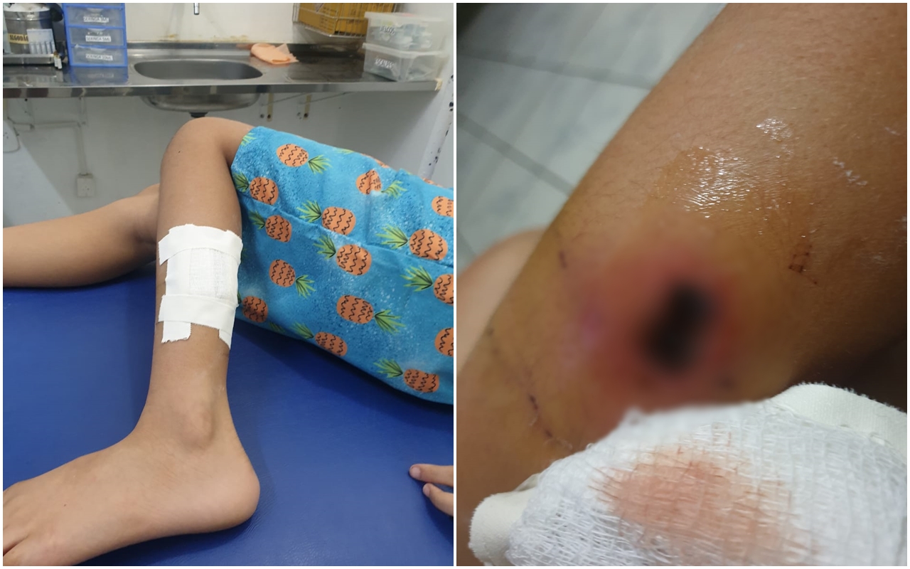 Família de criança atacada por cachorro de rua aciona justiça para que o Município de Patos seja responsabilizado pelos danos causados