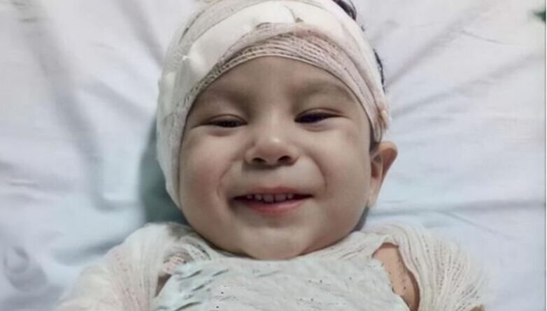 Família de criança que se queimou com óleo em Conceição arrecada mais de R$ 17 mil para tratamento