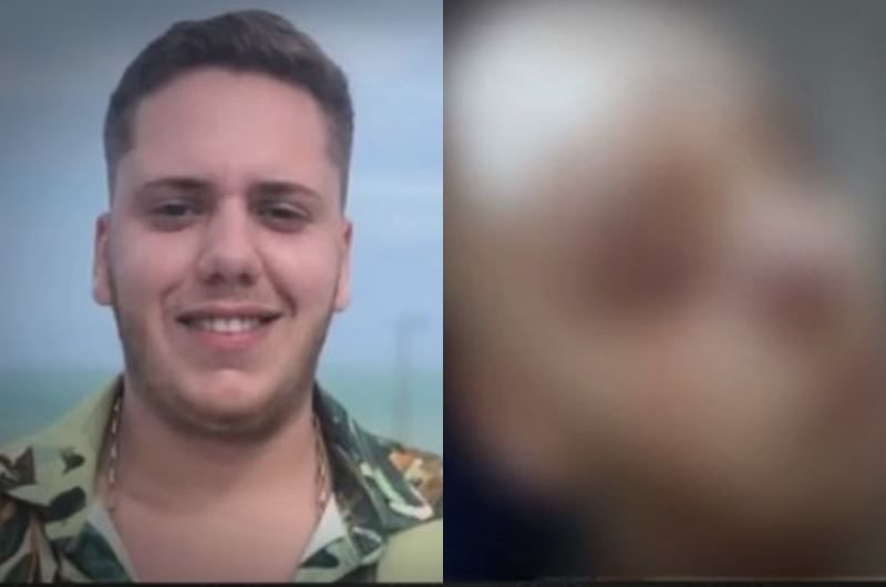 Após tentar separar briga em bar, jovem sofre golpes de facão e fica com rosto desfigurado, no sertão da Paraíba