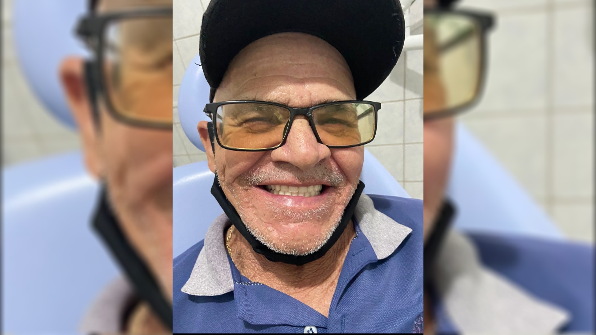 Baraunenses são beneficiados com próteses dentárias pela Prefeitura Municipal