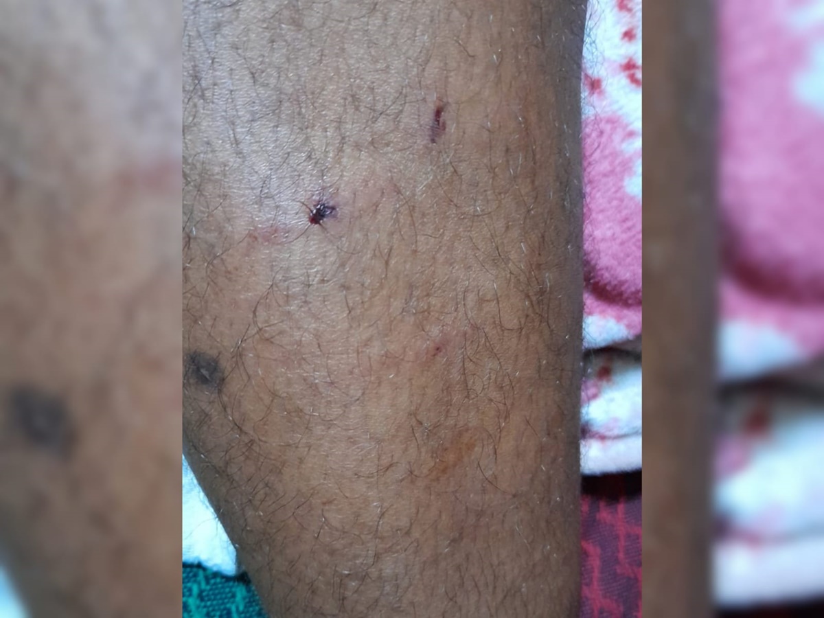 Entregador de gás é atacado por cães de rua na noite desta quarta-feira (29) em Patos