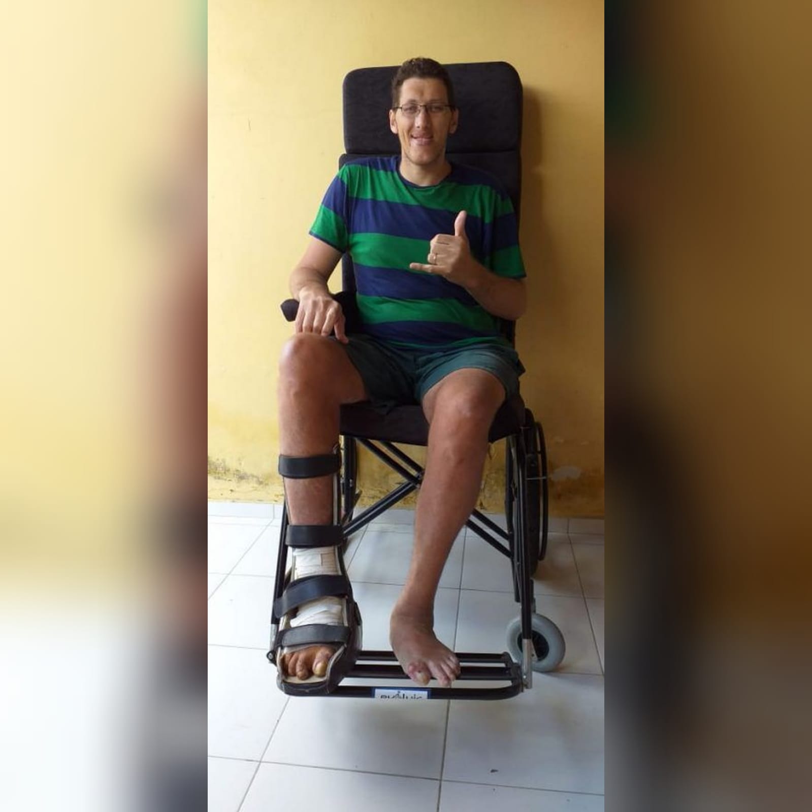 Homem mais alto do Brasil, Ninão garante cirurgia de amputação da perna e implantação de prótese
