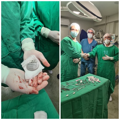 Patos começa a fazer história na medicina ao realizar primeiro implante de marca-passo do sertão. Veja