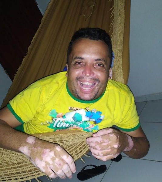 Por complicações da covid-19, morre Ivanildo Rodrigues, irmão da vice-prefeita de Santa Terezinha-PB