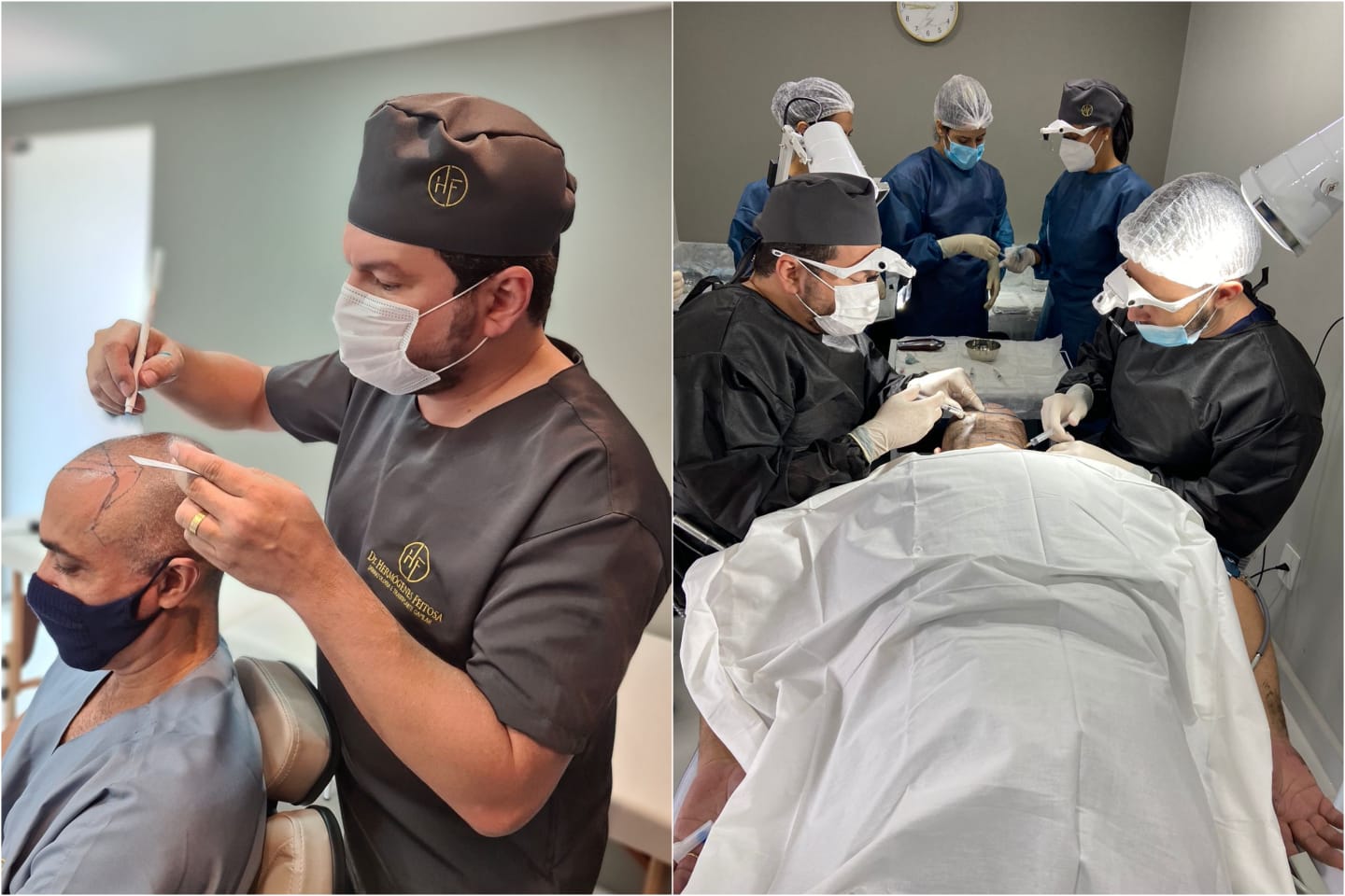 Médico Dr Hermógenes Feitosa é destaque na cidade de Patos-PB na área de Transplante Capilar