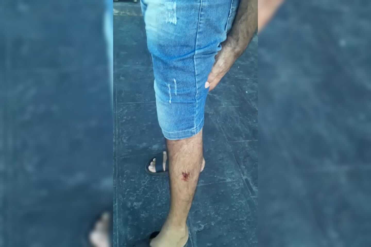 Motociclista é atacado por cães de rua na madrugada desta segunda-feira (31) no Centro de Patos