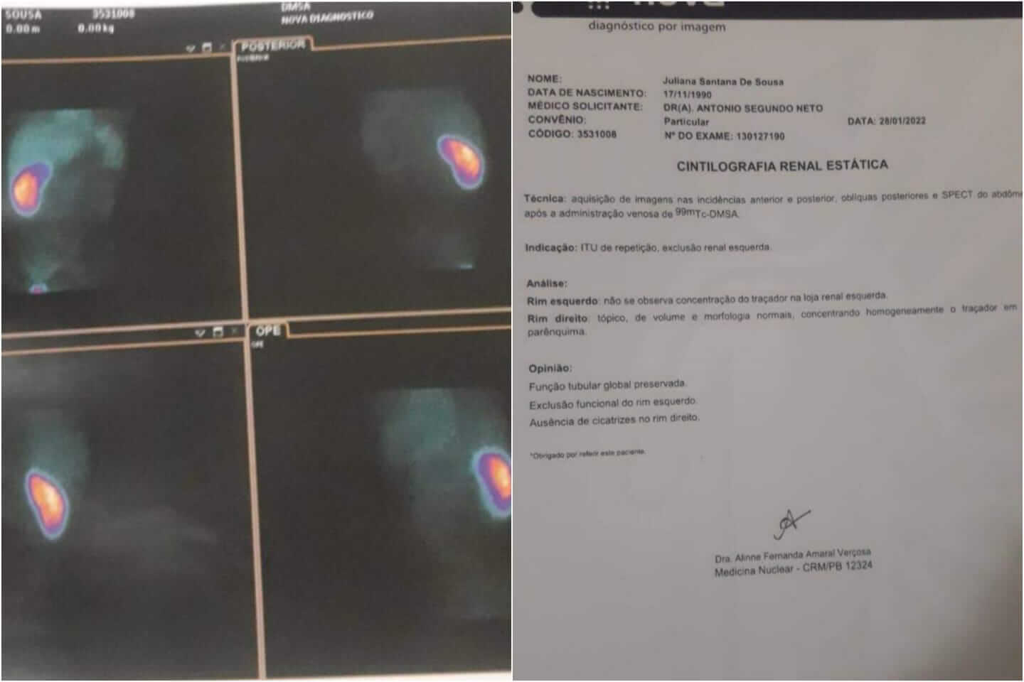Jovem patoense que está com rim paralisado precisa realizar cirurgia urgente que custa R$ 7 mil. Veja como contribuir