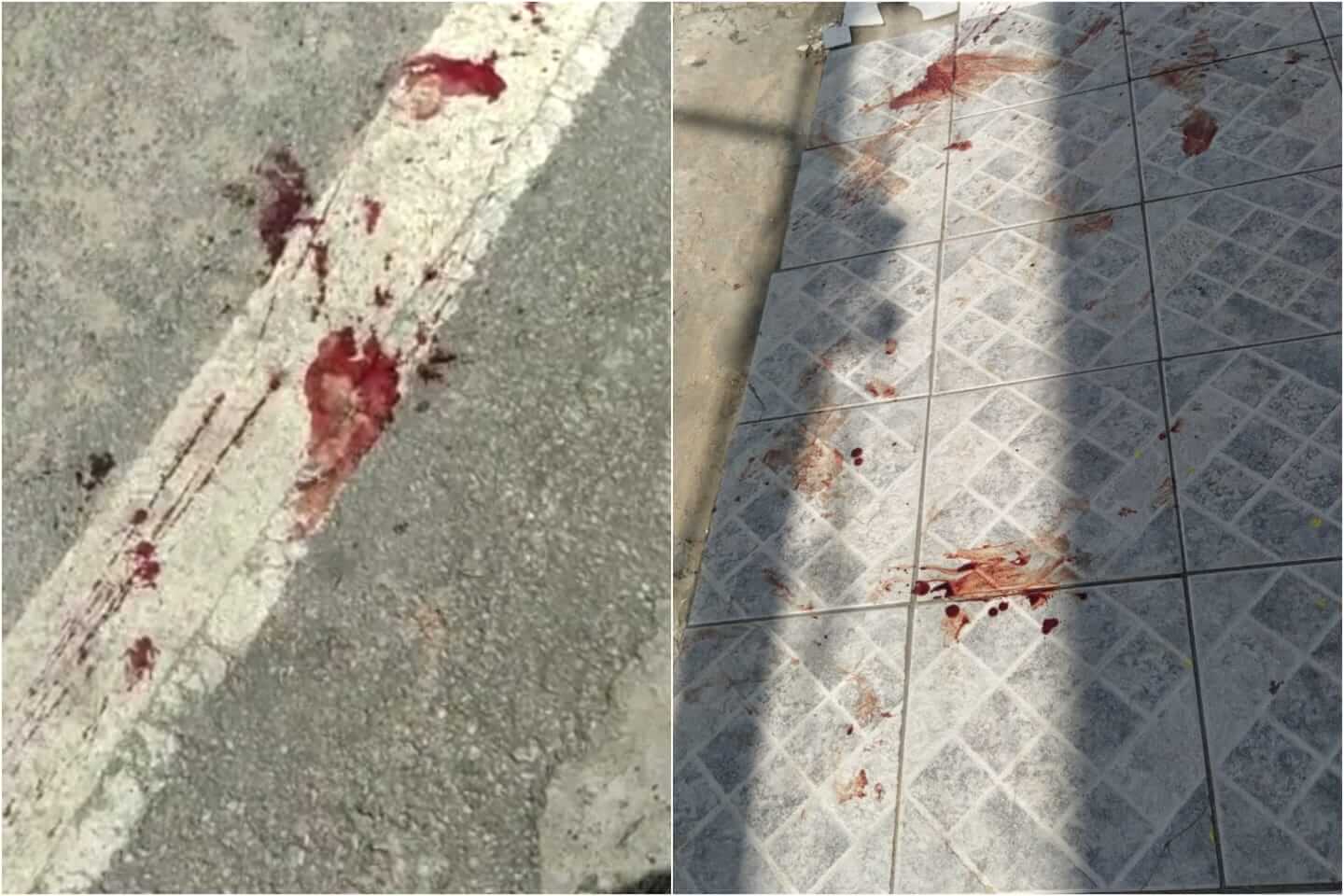 Homem tenta matar companheira a facadas na tarde desta quinta-feira (03), em Patos