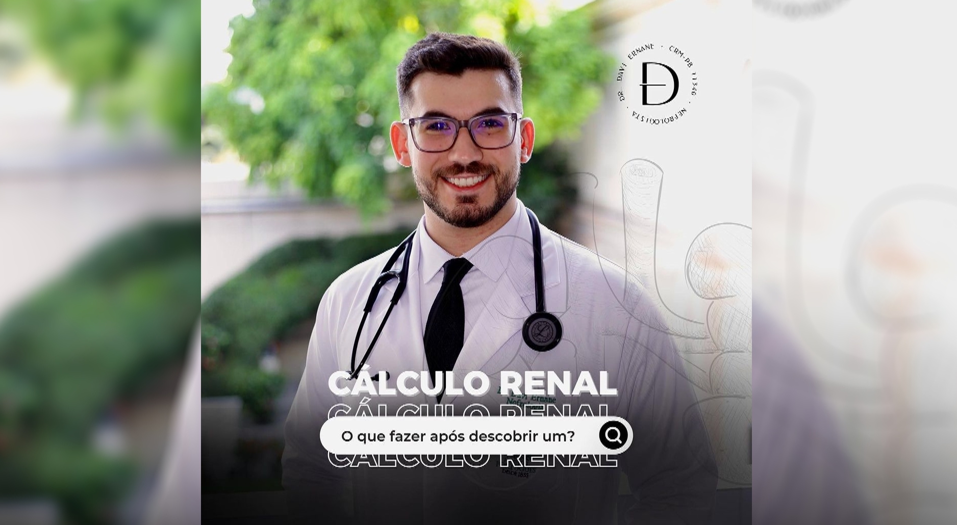 O que fazer após descobrir um Cálculo Renal? Dr Davi Ernane te Responde