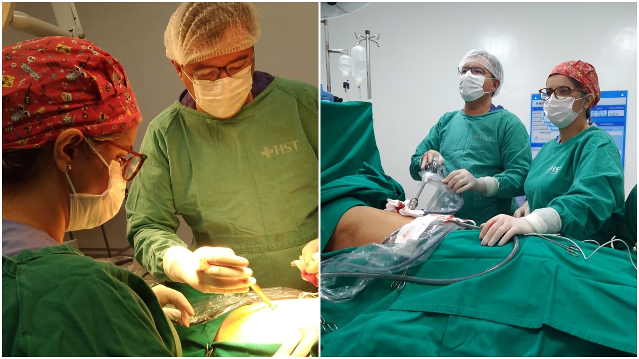 Cirurgiões Torácicos de Sousa realizam primeira Cirurgia Torácica por videotoracoscopia do Sertão