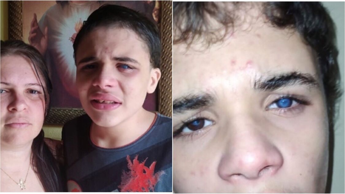 Garoto de 12 anos portador de Transtorno do Espectro Autista tem apenas 4% da visão e precisa passar por cirurgia de transplante de córnea urgente. Veja como ajudar