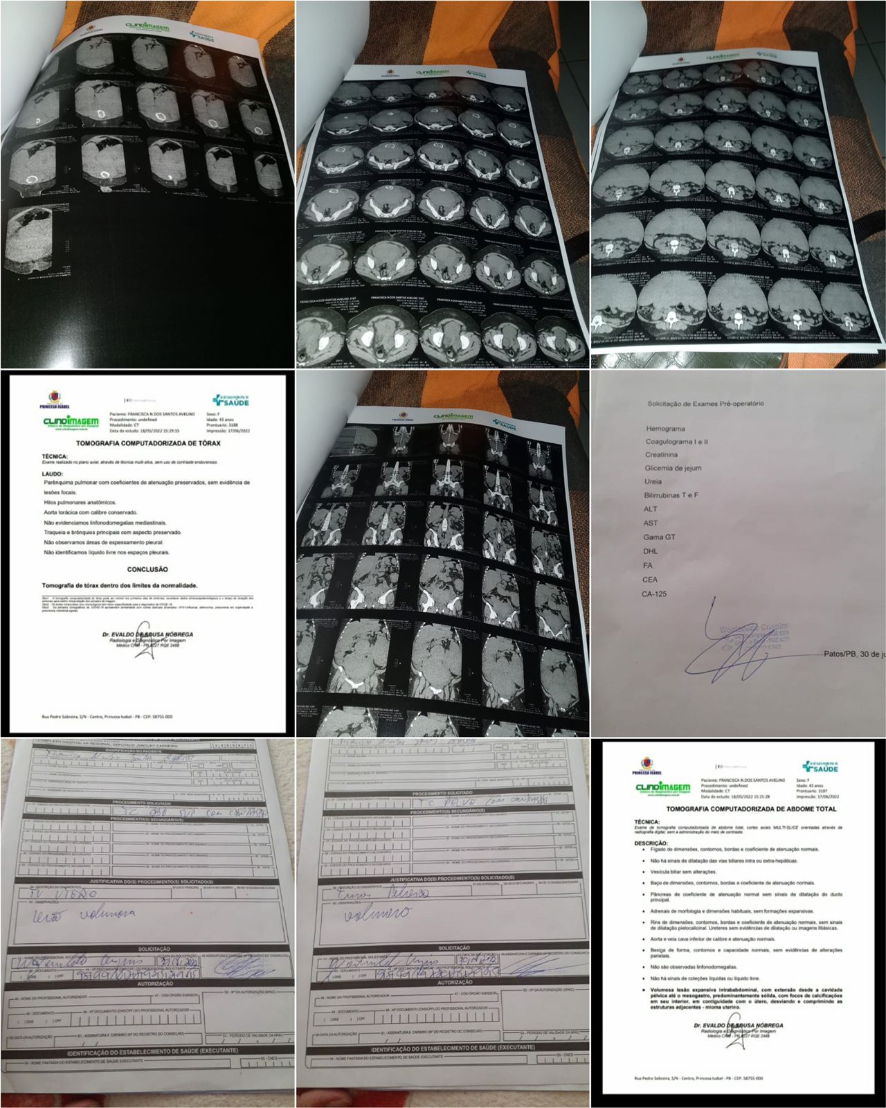 Mulher com problemas de saúde e impedida de trabalhar faz apelo para receber ajuda em Patos