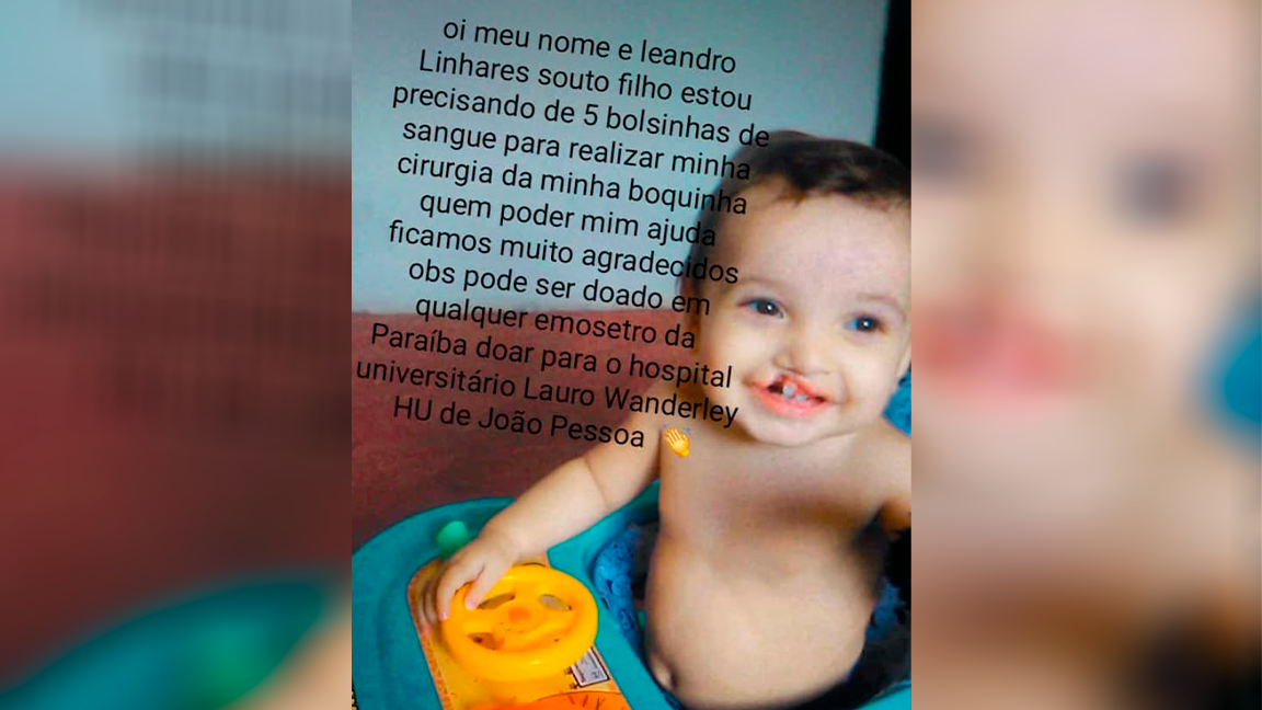Criança precisa de 5 bolsas de sangue para cirurgia e mãe faz apelo por doações. Ouça