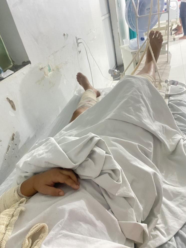 Jovem fica gravemente ferida e tem pernas quebradas após ser atingida por motorista embriagado, em Piancó