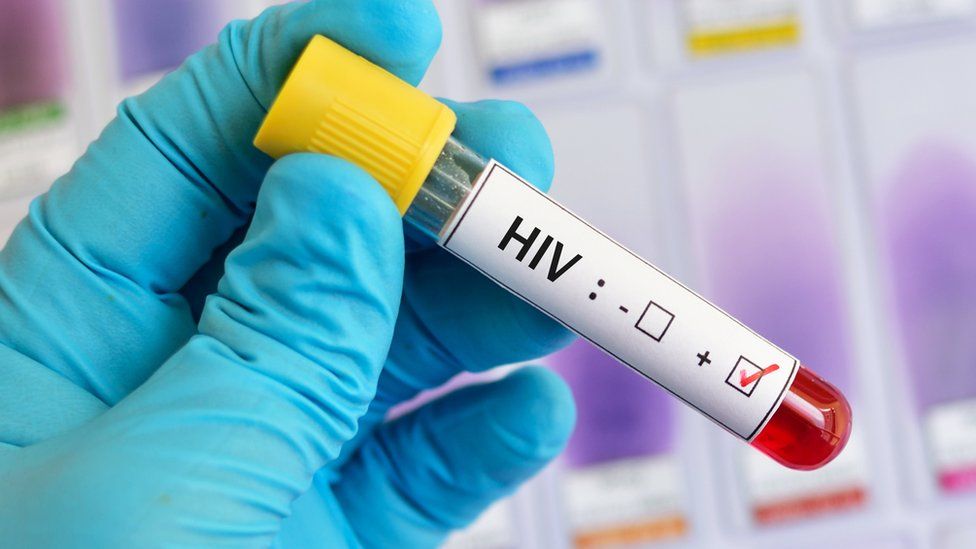 Paciente é declarado curado do HIV após receber células-tronco