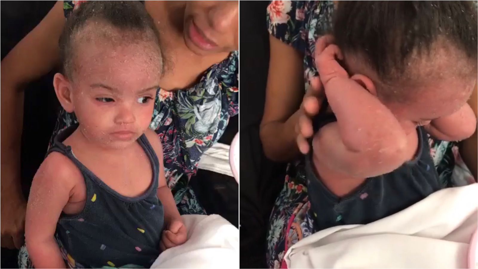 Família de criança patoense de apenas 2 anos portadora de dermatite atópica, que está aguardando vaga em João Pessoa, clama por ajuda. VÍDEO