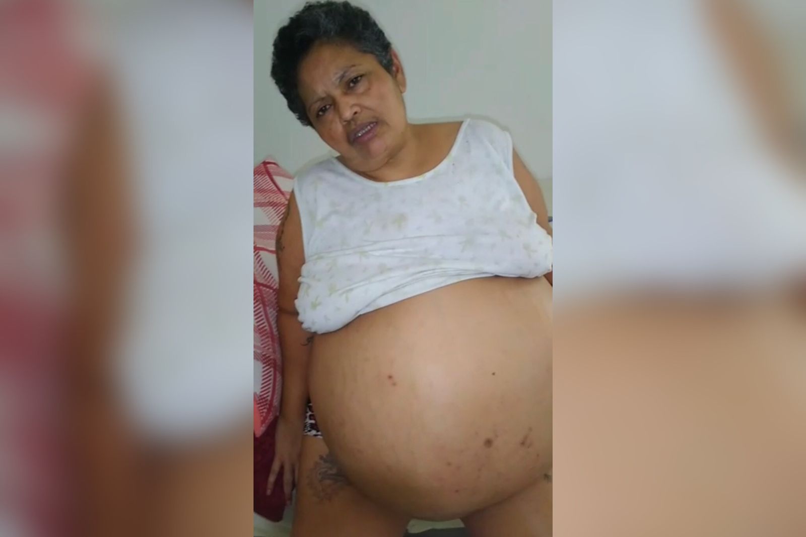 Mulher portadora de dois miomas e que está impedida de trabalhar, clama por cirurgia: 