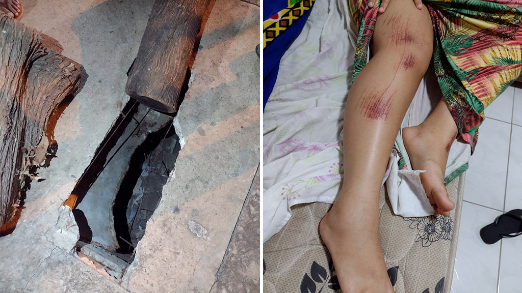 Adolescente fica ferida ao passar por tampa de concreto em calçada e a mesma ceder, no bairro São Sebastião, em Patos