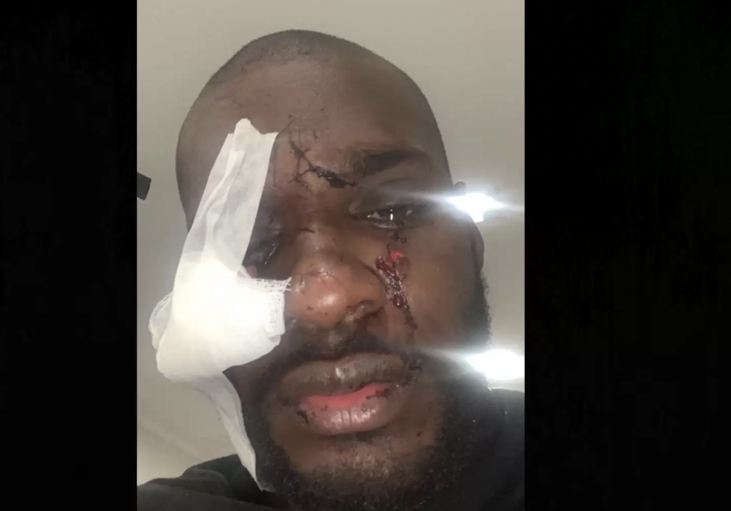 Jogadores de clube capixaba brigam por partida da Copa do Brasil; ferimento é grave