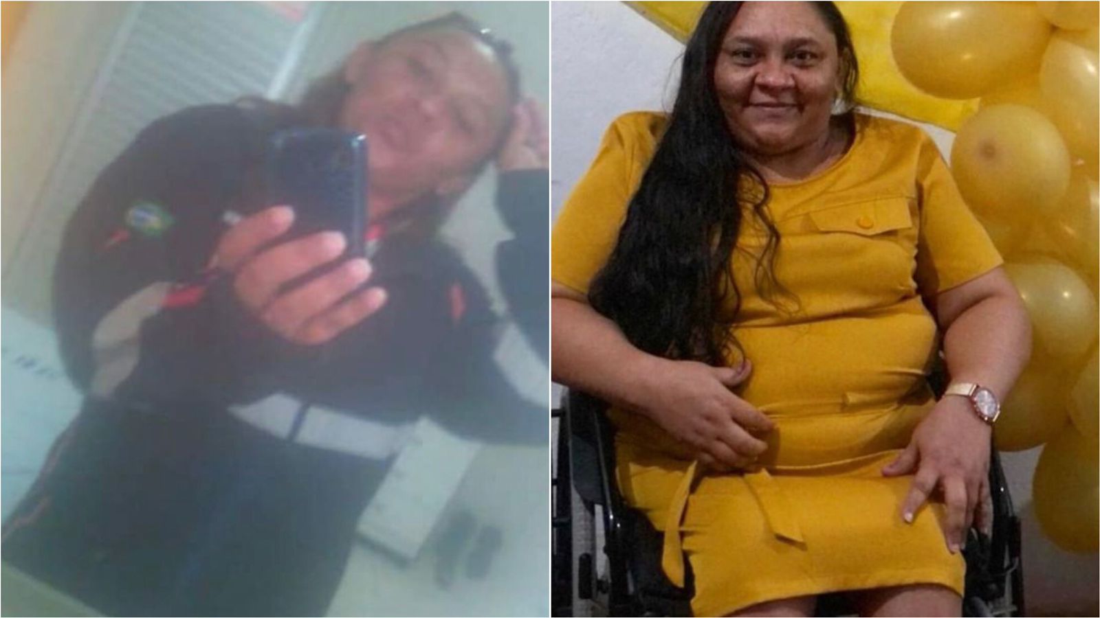 Após três anos de espera, Técnica de Enfermagem da cidade de Passagem-PB consegue cirurgia que ultrapassa os R$ 100 mil e cria vaquinha para custeio do pós-operatório