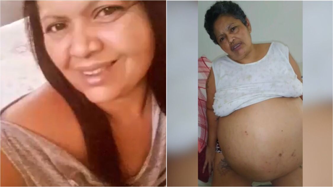 Mulher portadora de dois miomas está realizando campanha para custear gastos com cirurgia que será realizada em João Pessoa. Confira
