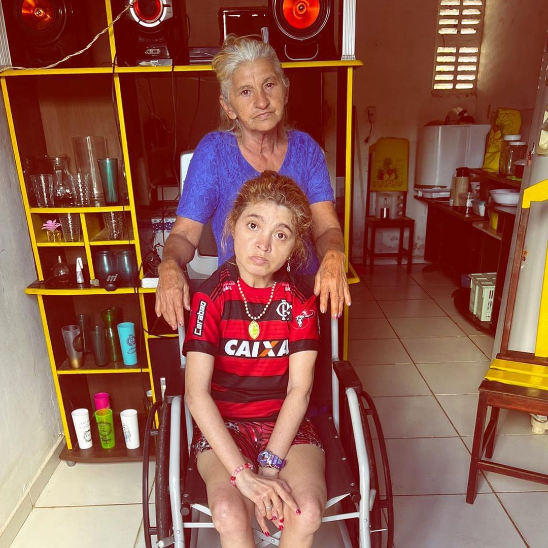 Prefeitura de Salgadinho-PB entrega Cadeira de Rodas e faz convite para o Setembro Amarelo