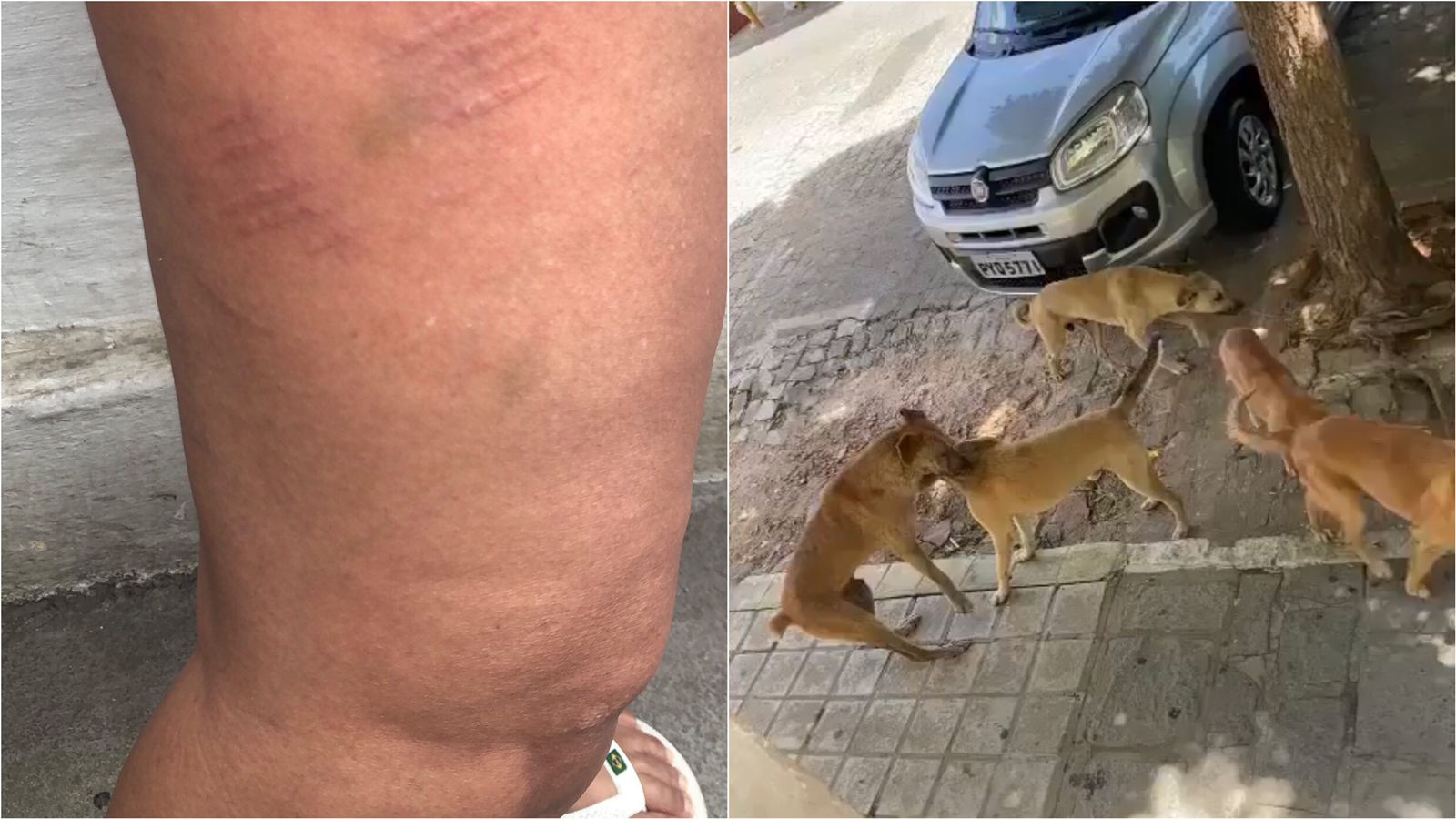 Mulher é atacada por cães de rua na frente de casa, no Centro de Patos. Prefeitura se posiciona e diz que animais estão sendo recolhidos e castrados