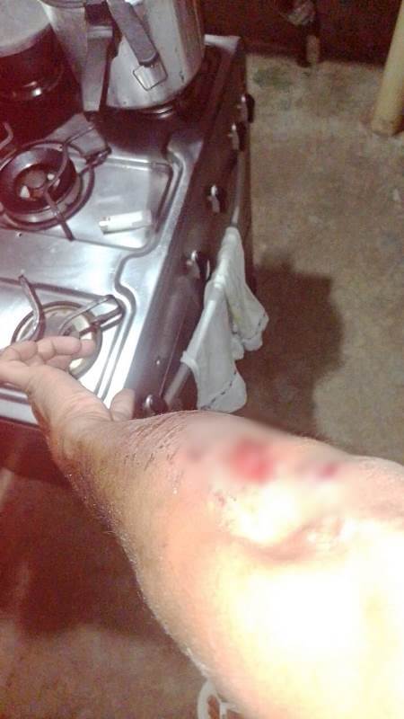 Em Patos: Entregador de delivery diz que foi perseguido por homem em carro com arma em punho, sofreu disparos, caiu de moto e foi agredido