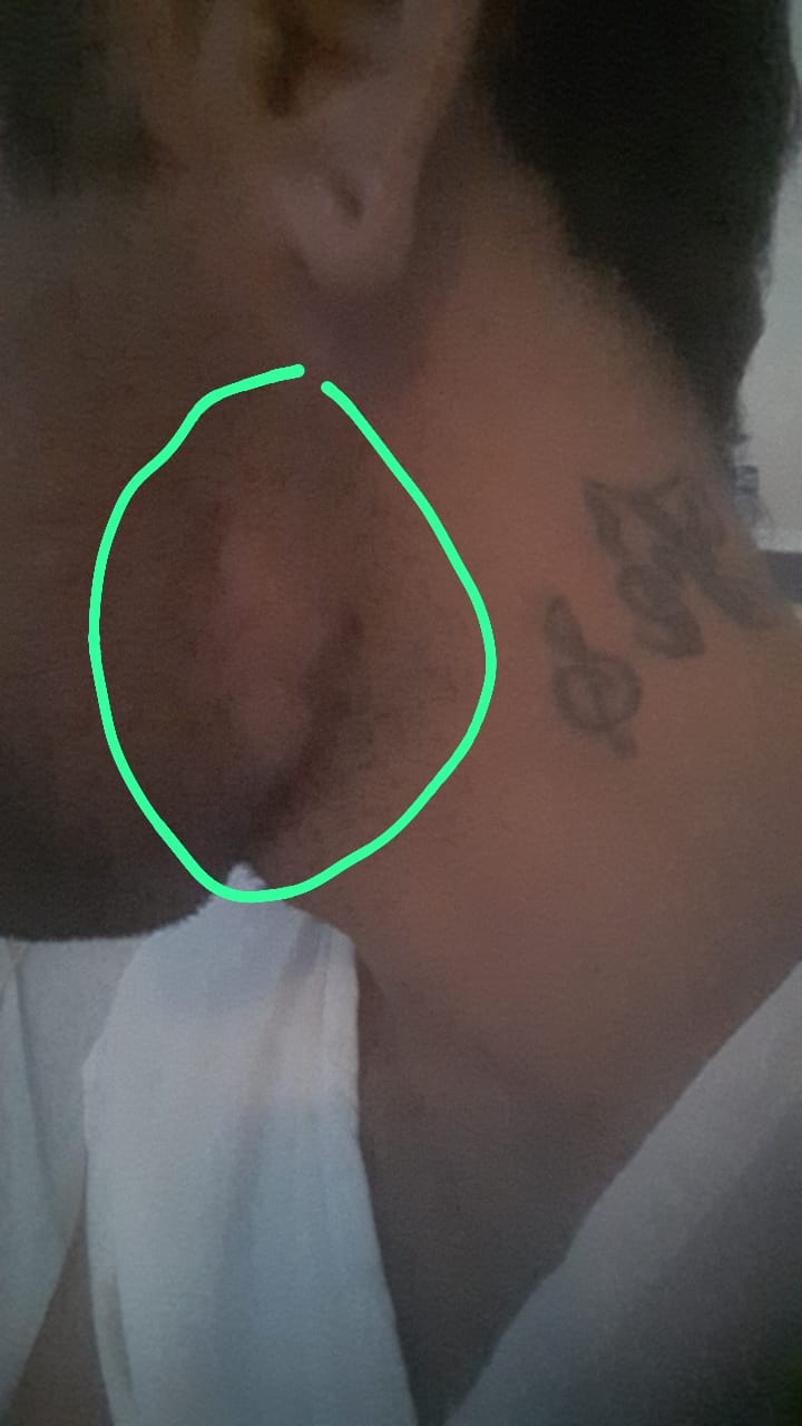 Popular DJ Alisson pede ajuda para enfrentar tratamento contra tumor no rosto. Saiba como contribuir