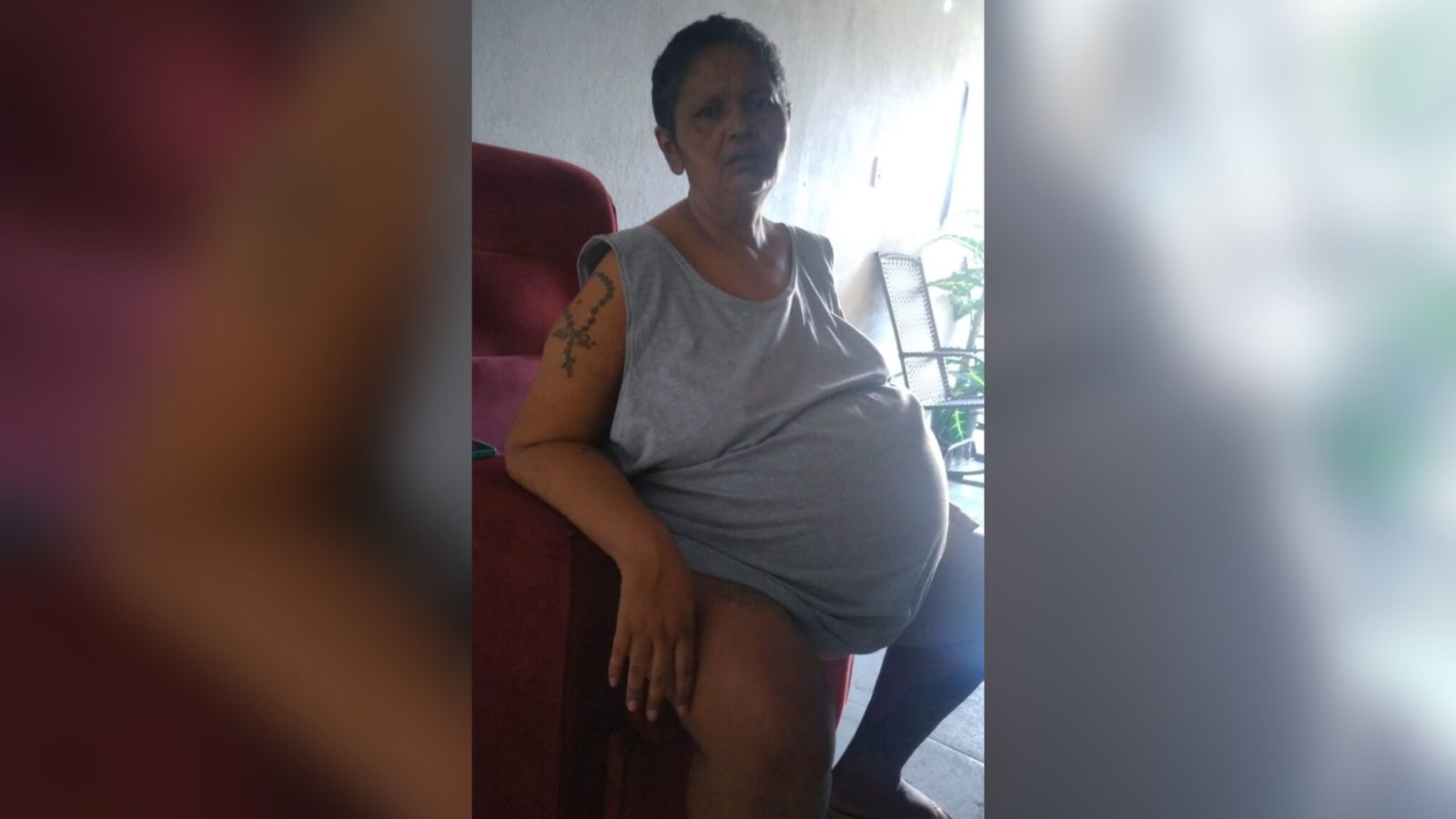 Patoense que está em tratamento de mioma e impossibilitada de trabalhar faz campanha para conseguir alimentação e produtos de higiene. Veja como contribuir