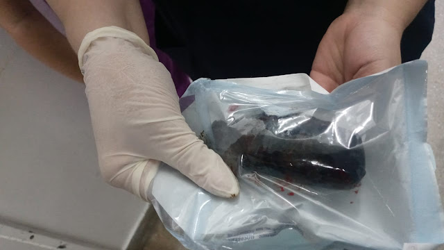 Mulher que tentou entrar no presídio de Cajazeiras com droga no ânus se submete a cirurgia no hospital