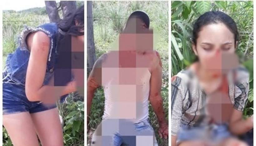 Acidente de moto deixa 3 pessoas feridas, na zona rural de Conceição