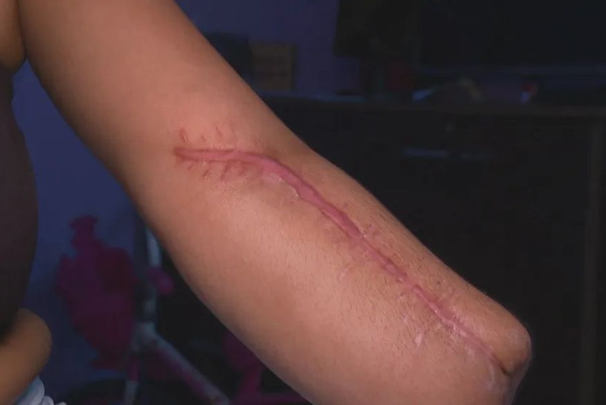 Mulher vai a hospital no Rio de Janeiro para dar à luz e sai com mão amputada