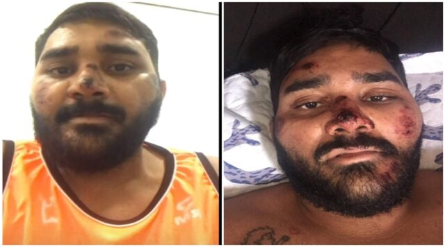 Professor sofre acidente de trânsito após cão de rua atravessar na frente de sua motocicleta, no Centro de Patos