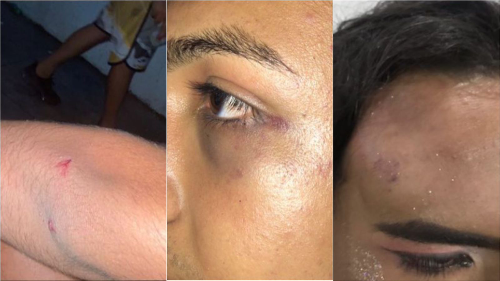 Jovem diz ter sofrido homofobia e agressões físicas, durante festejos carnavalescos em São José de Espinharas-PB