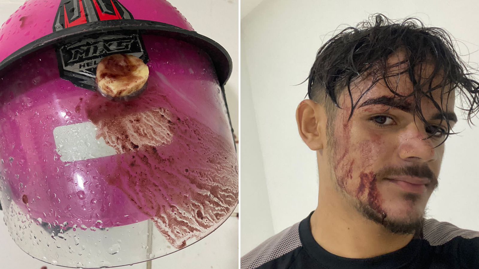 Em Patos, entregador de delivery relata que teve açaí arremessado contra o rosto após pedido chegar derretido devido à demora na entrega; Veja Vídeo