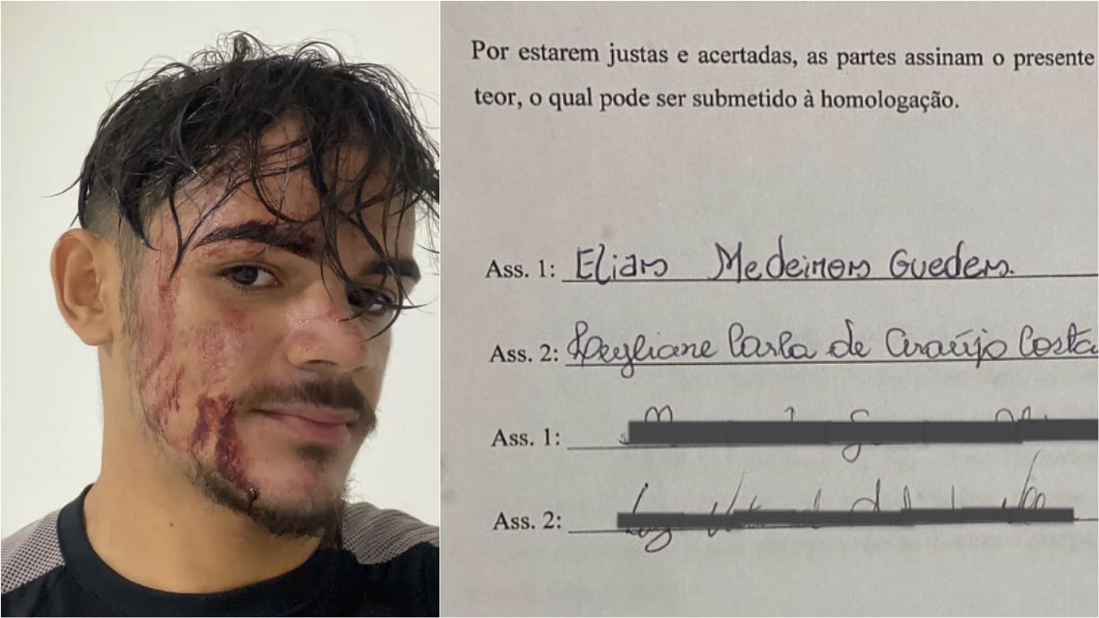 Desfecho final: motoboy divulga imagens de contrato e diz que chegou a acordo com cliente que teria arremessado açaí contra seu rosto