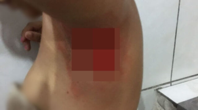 Em Coremas: Adolescente de 12 anos esfaqueia colega de escola com 5 golpes de punhal; delegado comenta o caso. VÍDEO