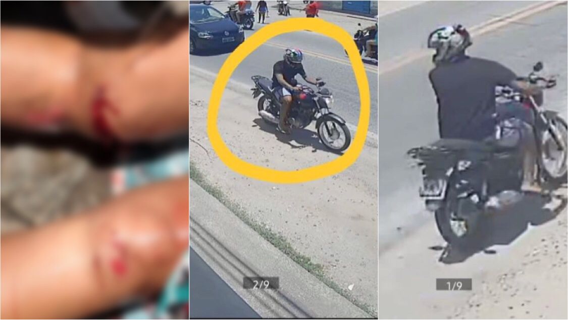 Em Patos: Mulher sofre fratura exposta na perna após acidente e motociclista foge sem prestar socorro