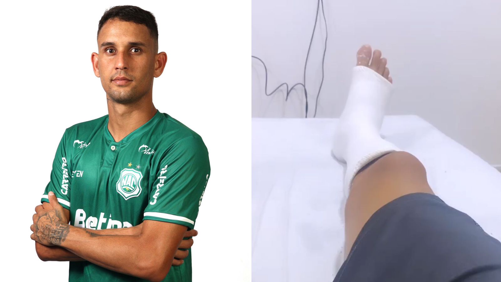 Desfalque no Nacional: Zagueiro Arlan Barros sofre lesão durante treino e está fora do Campeonato Paraibano 2023