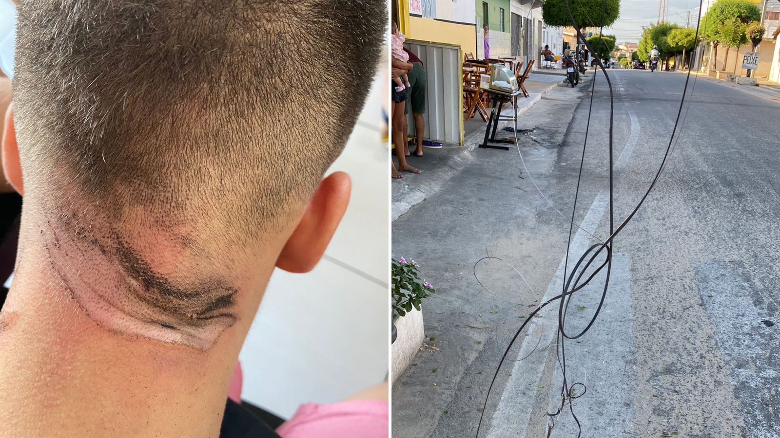 Cabos de internet provocam acidente na tarde deste sábado (04), em Patos