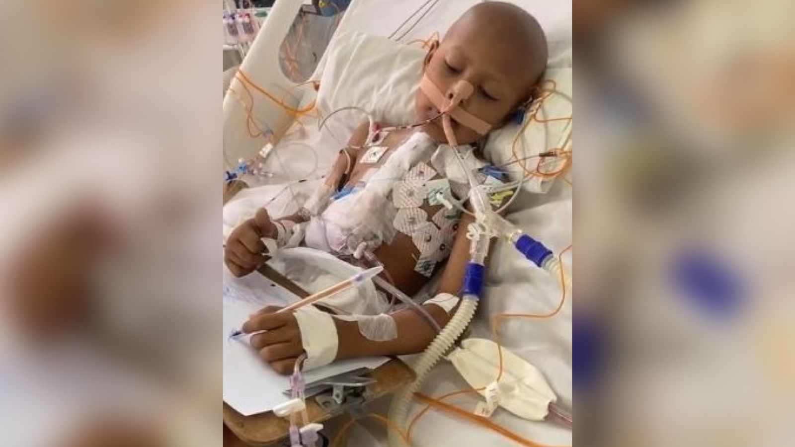 Morre o garoto patoense Antony Carlos, de 8 anos, que lutava contra uma doença cardíaca desde pequeno; 