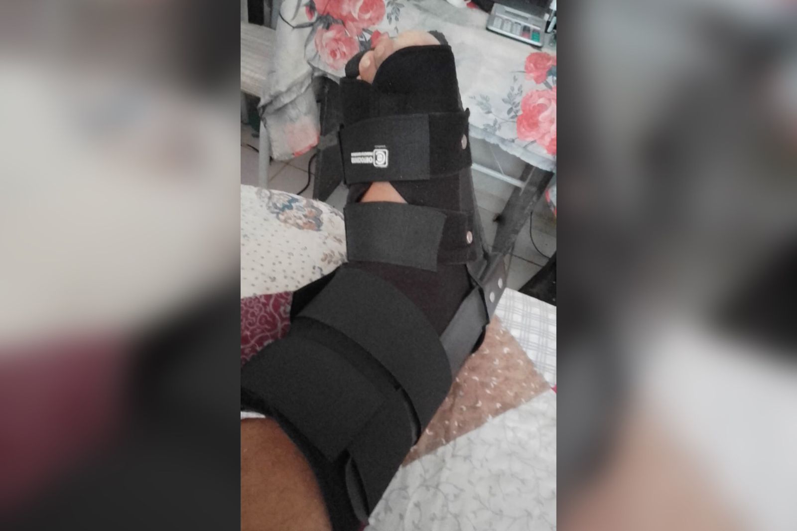 Trabalhador que sofreu acidente e fraturou a perna, pede ajuda financeira para pagar contas: 