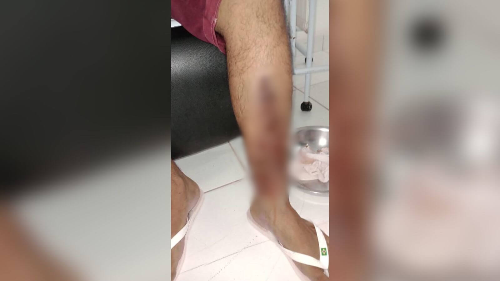 Paciente com ferimento na perna em decorrência de rejeição de platina denuncia que teve atendimento negado no Hospital Regional de Patos; direção se posiciona e emite nota